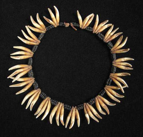 teeth diagram numbered. Adult and quot;Babyquot; teeth diagram. Note the non-standard Dental notation