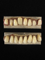 Curiosities - Artificial teeth, Italy